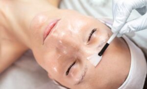 CHEMICAL PEELS: EVERYTHING YOU NEED TO KNOW